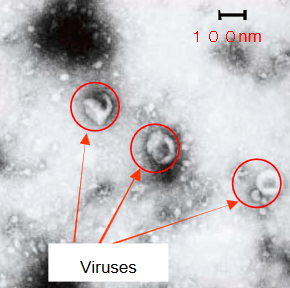 Coronaviren unter dem Mikroskop